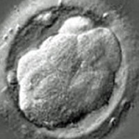 adopting a child, how to adopt a child, adopt a child,Egg donors